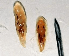 Opistorchi