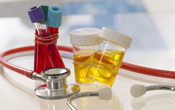 Parazitlerin tanımlanması için analizler