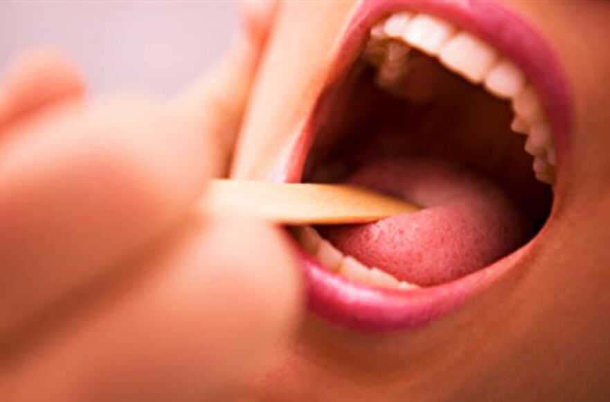 insan ağzındaki parazit türleri